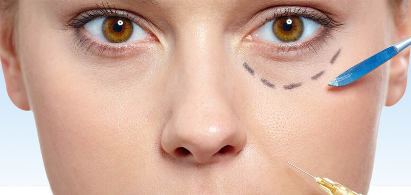 Enhance Your Facial Glow with Under Eye Fillers