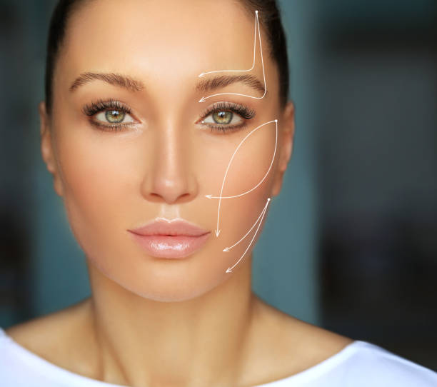 How Does Forehead Lift Affect Eyebrow Position