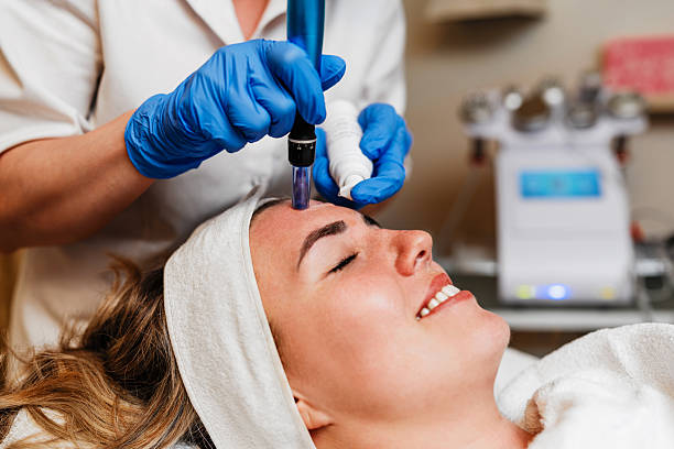 How Does Microneedling Affect Sensitive Skin Types