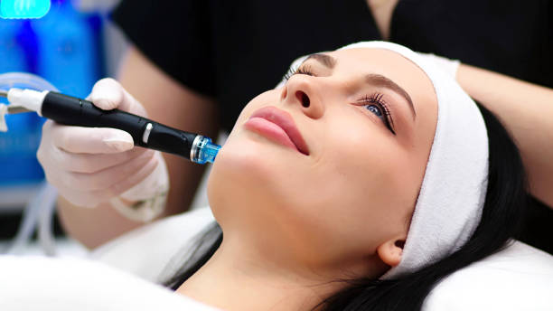 How HydraFacial Removes Blackheads and Impurities