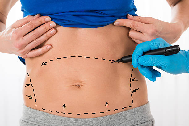 How Lower Body Lift Helps Restore Youthful Shape