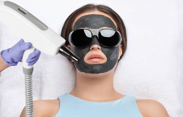 How Soon Will You See Results From a Carbon Laser