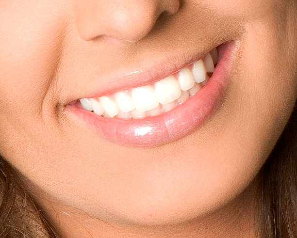 How Teeth Whitening Improves Overall Appearance