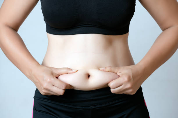 Is CoolSculpting a Good Choice for Arm Fat Reduction