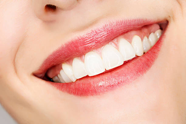 Is E-Max Veneers the Best Choice for Smiles