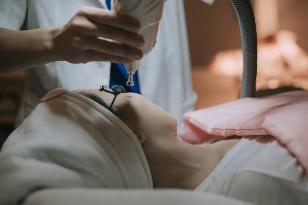 Is Pico Laser Better Than Fractional or CO2 Laser Treatments