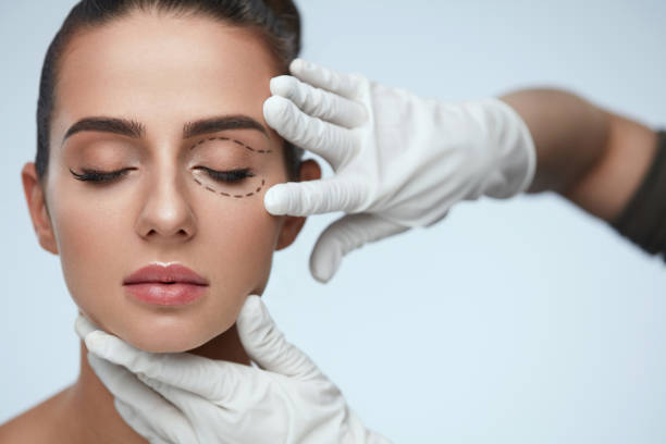 What Eyelid Surgery Success Rates Look Like?