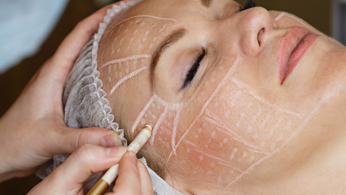 What Results Can Liquid Facelift Deliver