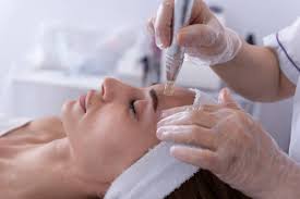 What Results Can Microneedling Deliver