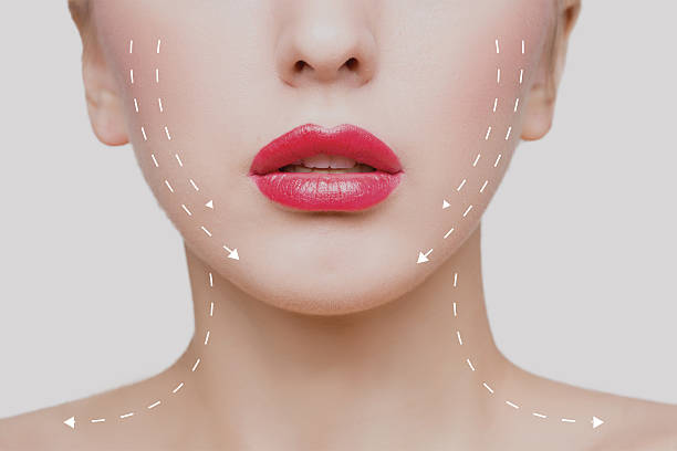 Does Double Chin Liposuction Change Your Jawline Shape