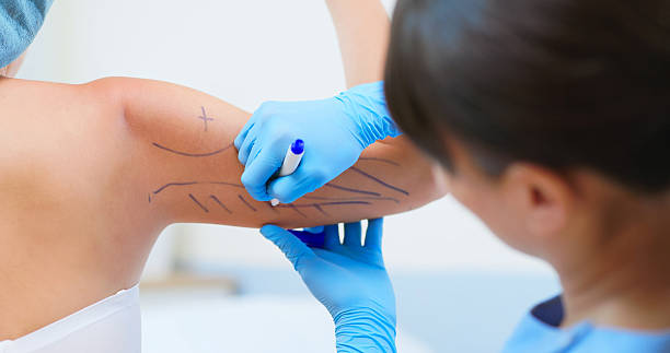 How Does Arm Lift Work for Post Weight Loss Skin