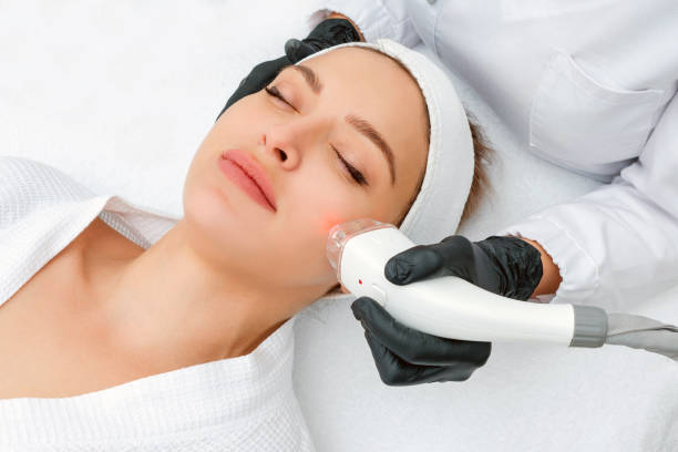 How Does Laser Hair Removal Work on Light Hair