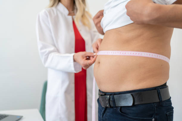 How Long Does Liposuction Surgery Recovery Take?