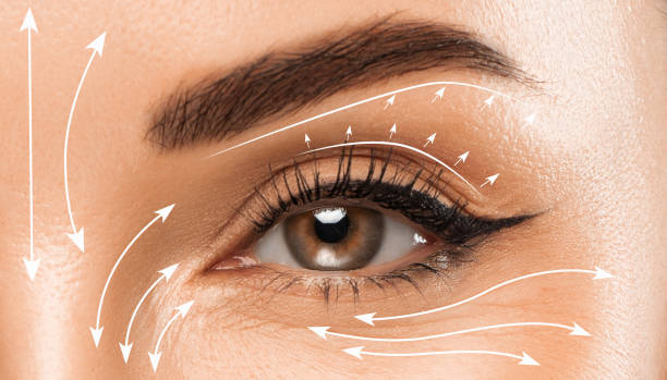 Is Eyelid Surgery Effective for Droopy Eyes?