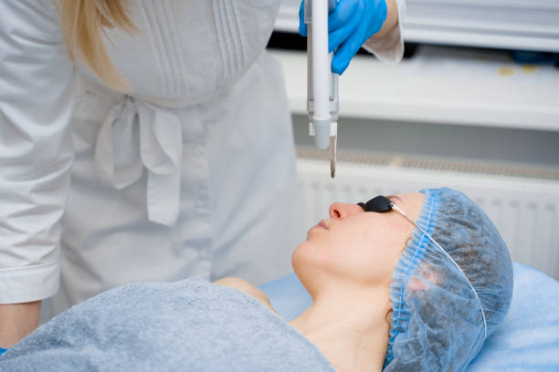 Is Pico Laser Suitable for Acne-Prone Skin