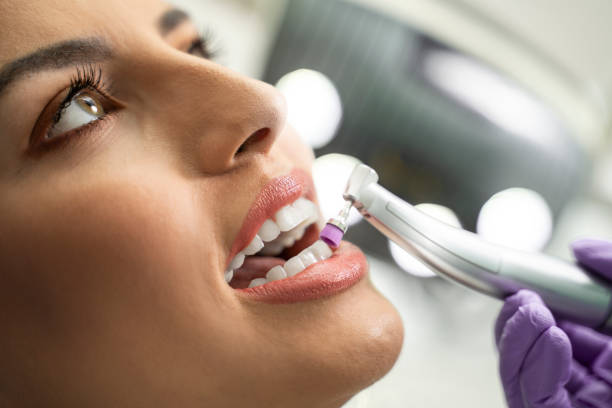Is Teeth Cleaning the Right Step Before Whitening Treatments