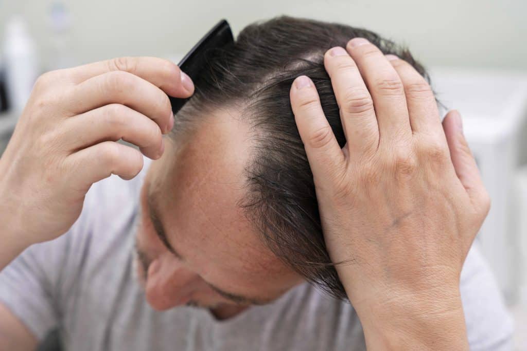 What Results Can Hair Loss Treatment Deliver