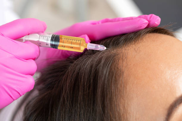 How Can Best PRP Hair Treatment Boost Hair Growth Naturally