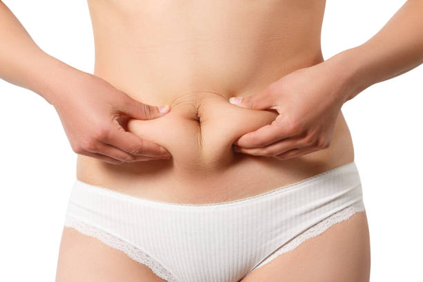 How Long Does coolsculpting Keep Fat From Returning