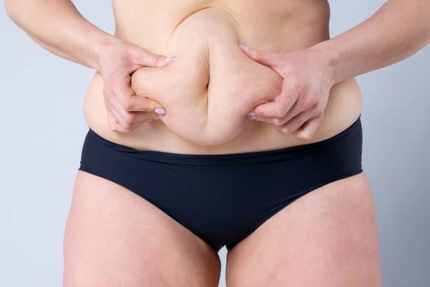 What Mini Abdominoplasty Methods Deliver Natural Results