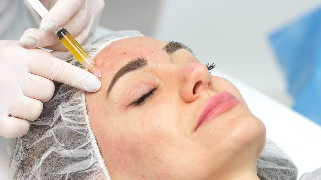 PRP treatment in Abu Dhabi