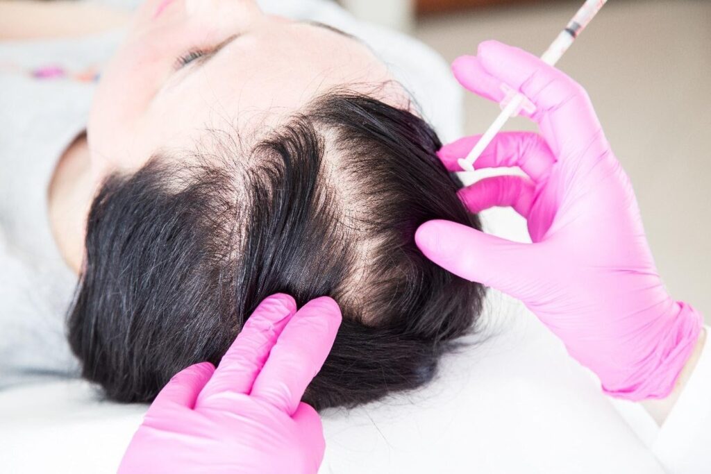 Acell PRP Treatment in Abu Dhabi