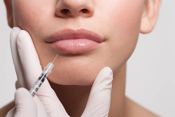 Does Botox Work for Lip Flip Treatments