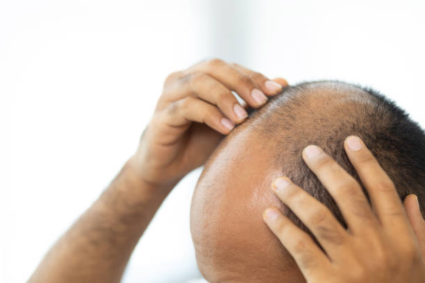 Does Hair Loss Treatment Deliver Noticeable Results Fast