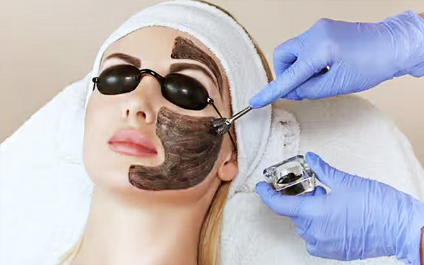 Laser Carbon Peel Abu Dhabi