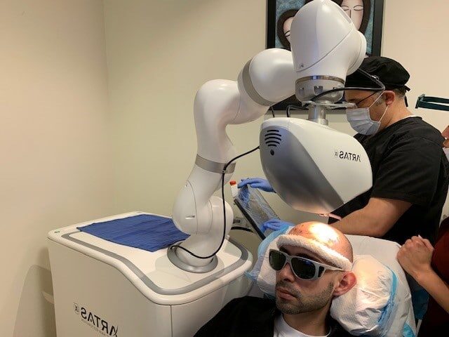 Robotic Hair Transplant in Abu Dhabi