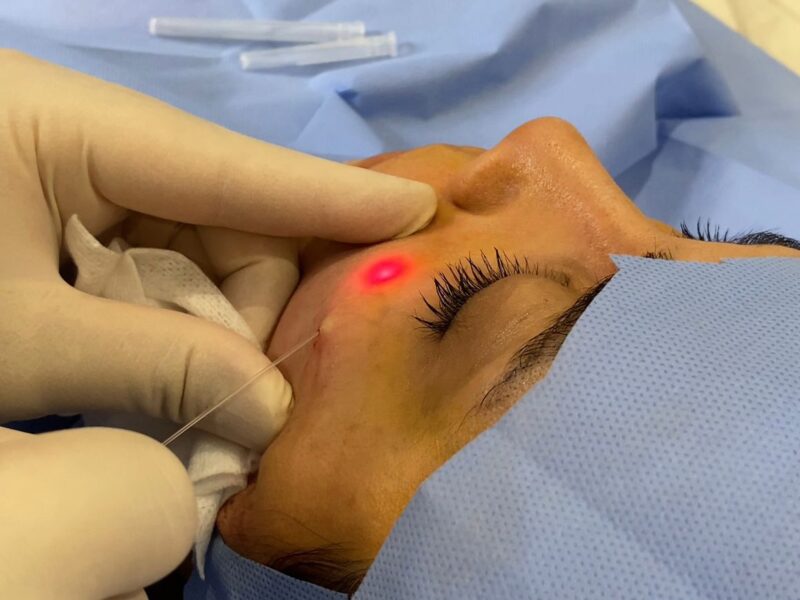 UltraClear Laser UAE