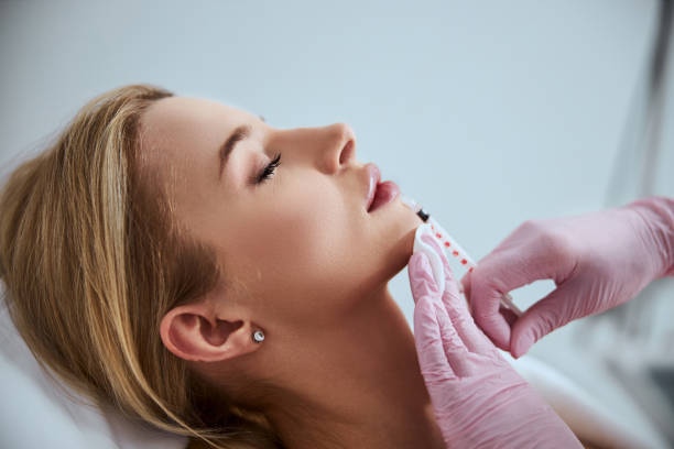 Is Lip Filler Effective for Naturally Thin Lips