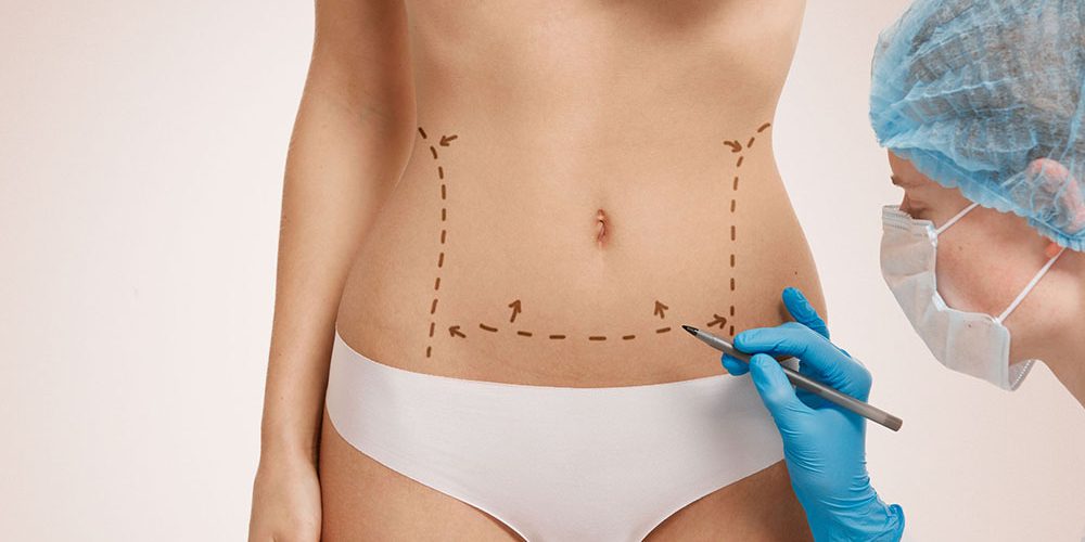 Liposuction Abu Dhabi