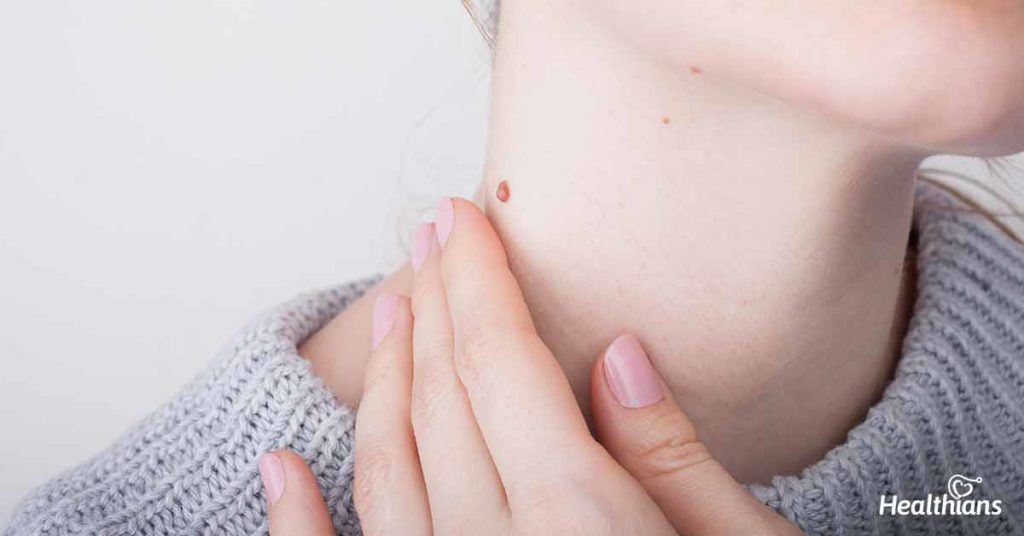 Skin Lesion Removal Abu Dhabi