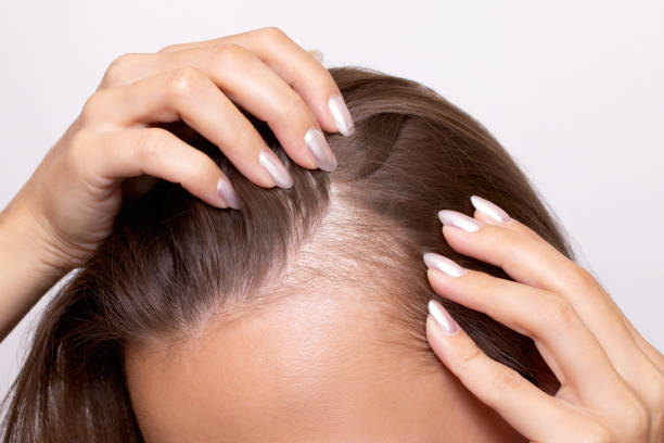 Can PRP Hair Treatment Increase Hair Growth Naturally