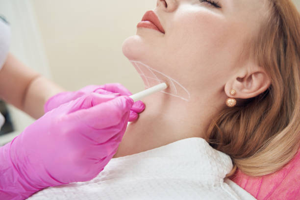 Does Liposuction help define the jawline