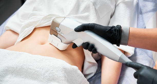 Is Full Body Laser Hair Removal Cost worth long-term