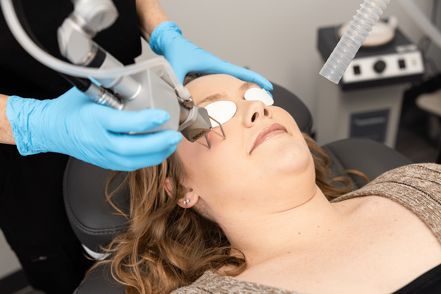 Laser Skin Resurfacing Abu Dhabi